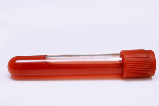 Close Up Of Blood Test Tube Isolated On White Background. 