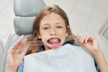 Little patient of dental clinic holding mouth retractor.