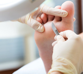 podólogo eliminando dureza del pie a una mujer