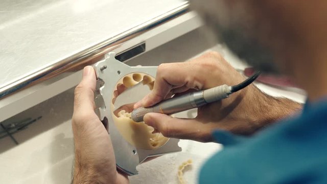 Crop orthodontist carving dental impression