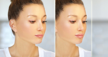 Beauty injections.Concept of rejuvenation.Lip augmentation	