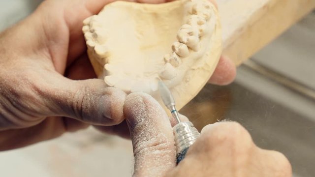Technician carving teeth on denture