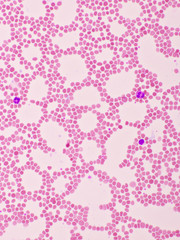 Picture of white blood cell, red blood cell and platelet in blood film, analyze by microscope, 400x 