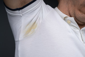 Yellow Sweating Very Badly Under Man's Armpit