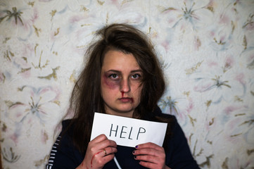 A battered young wife with a bruised lip and nose, suffers from violence, beatings and bullying of...