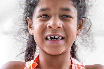 close up girl mouth with crooked broken teeth and odontolith, will need a dental appliance