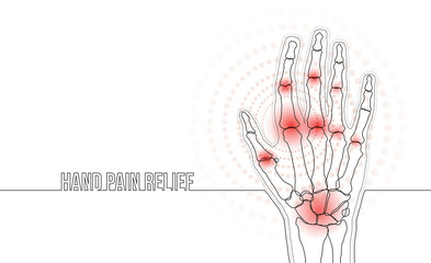 Rheumatoid arthritis continuous line hand bones drawing concept banner