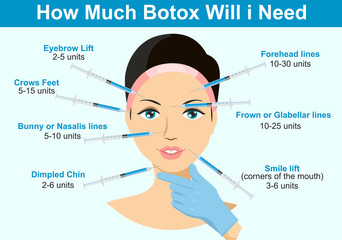 botox Injection" photos, royalty-free images, graphics, vectors ...