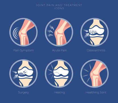 Set Of Icons Of The Joints And Their Treatment Cartilage Damage,  Arthritis, Osteoarthritis, Restoration Of Cartilage, Joints Pain. Flat Icons In A Round.