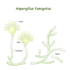 Aspergillus fumigatus is  a type of fungus causes aspergillosis - obrazy, fototapety, plakaty