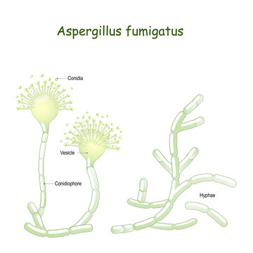 Aspergillus fumigatus is  a type of fungus causes aspergillosis