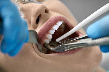 Pretty woman's teeth treatment in dental clinic - 303717967