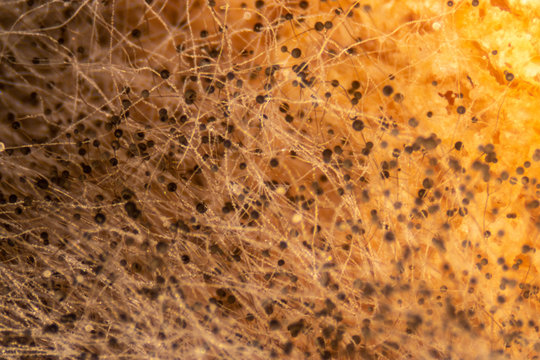 Rhizopus (bread mold) is a genus of common saprophytic fungi,Rhizopus (bread mold) under the microscope.