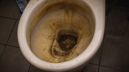 Why let your toilet look like this when you have bleach in your house?