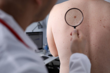 Male doctor look at magnifying glass on patient skin