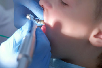 Dentist hygienist making oral hygienic cleaning in dentistry for teen child boy, face closeup. Using professional electrical equipment electric toothbrush to brushing teeth in dentistry, visit doctor.