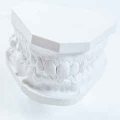 Gypsum model of human jaw on a white background.