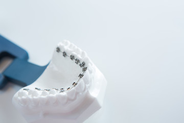 Dental lower jaw bracket braces model on white