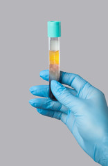 Cosmetologist does prp therapy on the face of a beautiful woman in a beauty salon. There is in...