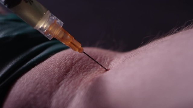 Close-up of a man shooting up heroin into his arm with a needle