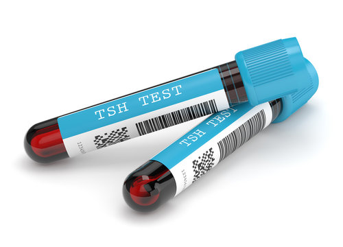 3d render of TSH test blood tubes over white