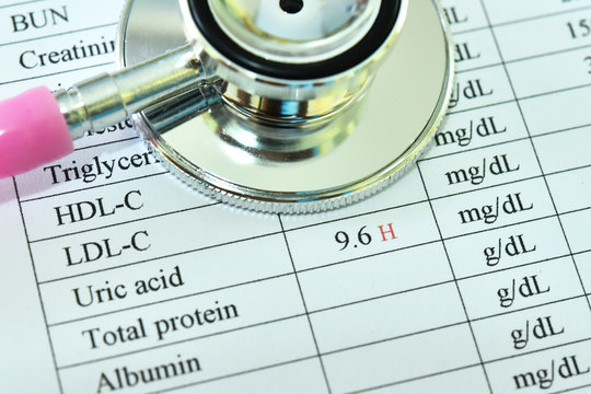 Abnormal High Uric Acid Test Result