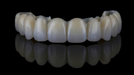 high-quality temporary denture for the upper jaw without a beam on black glass © Dental Pro Content