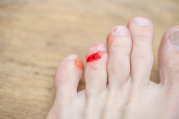 blood on the toe of a man's foot close-up. concept of health and hygiene