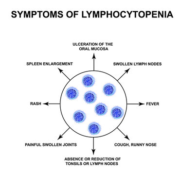 Symptoms of lymphocytopenia. Decreased lymphocytes in the blood. Infographics. Vector illustration on isolated background.