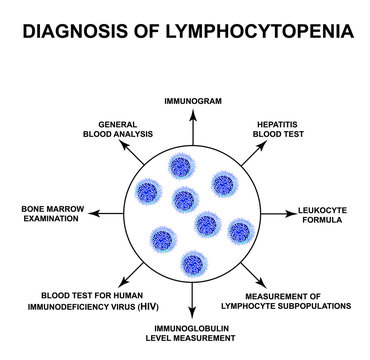 Diagnosis of lymphocytopenia. Decreased lymphocytes in the blood. Infographics. Vector illustration on isolated background.