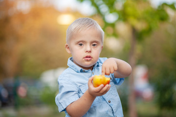 The daily life of a child with disabilities. A boy with Down syndrome eats a peach. Chromosomal and...