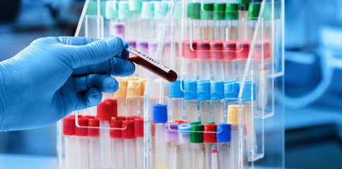 Lab technician with blood sample to analyze in the research laboratory / doctor taking a blood sample tube for analysis in the preanalytical lab