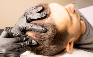 Male trichopigmentation service. Young man laying on the back on the esthetician table. Master...