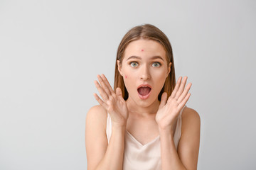 Portrait of stressed young woman with acne problem on light background