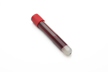 test tube with blood isolated on white background