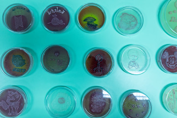 Backgrounds of Colony Characteristics of Bacteria in petri dish for education.