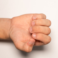 Teen's bitten nails close-up, top view. Onychophagy or onychophagia