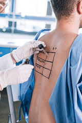 cropped view of allergist holding pipette and glass bottle near man with marked back