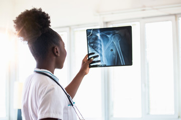 X-ray film image with doctor for medical and radiological diagnosis on female patient’s health on disease and bone cancer illness, healthcare hospital service concept