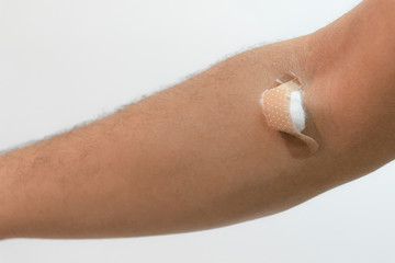 Man's arms attached to plaster after blood collection