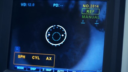 Refractometer machine. Patient testing eyes in clinic. Screen showing progress of eye examination. Close-up.