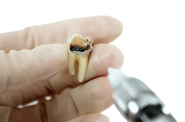 dental anesthesia in the tooth isolated on white background close-up, the dentist makes anesthesia