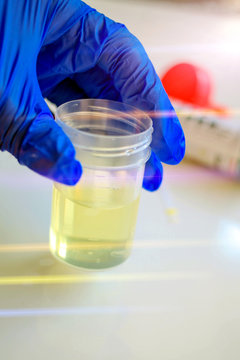 Urine Sample And Urine Analysis