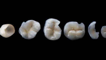 dental photo dental ceramic tabs on black glass, top view