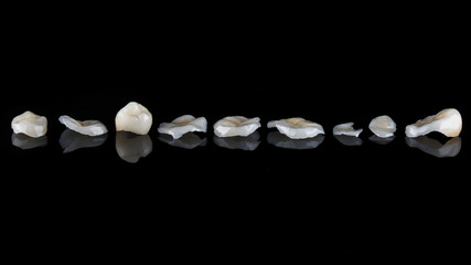 dental photo dental ceramic inlays and veneers on black glass