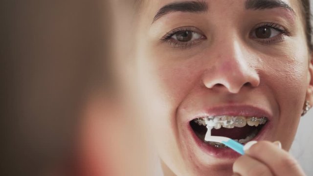 Oral hygiene with metal braces. Brushes teeth with a special toothbrush and toothpaste in the bathroom opposite the mirror. Close-up.
