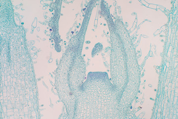 Shoot meristem is the tissue in most plants containing undifferentiated cells.