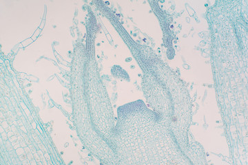 Shoot meristem is the tissue in most plants containing undifferentiated cells.