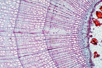 Xylem is a type of tissue in vascular plants that transports water and some nutrients.