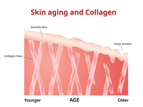 Skin aging, Collagen in young and old skin,